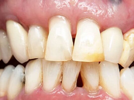 Where is a good place to fix yellow teeth in Bangkok