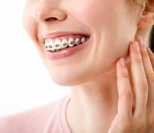 Where is a good place to get braces in Bangkok