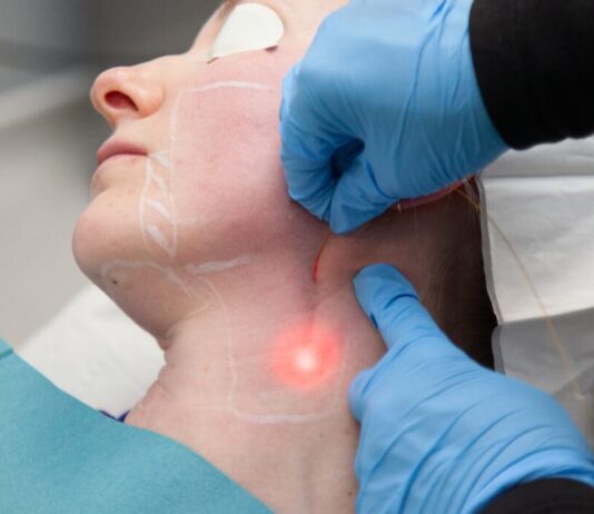 Endolift ที่ไหนดี - 1